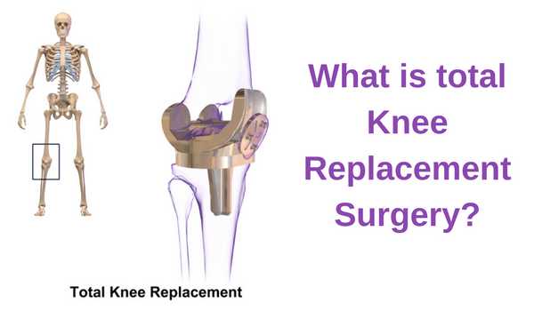 Knee Replacement Surgery in Bangalore | Knee Joint | Knee Pain